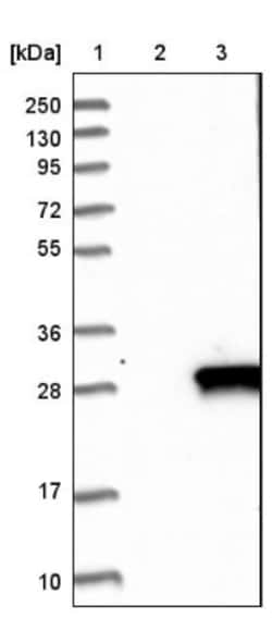 DUSP14 Antibody, Novus Biologicals 0.1mL; Unlabeled:Antibodies, Polyclonal